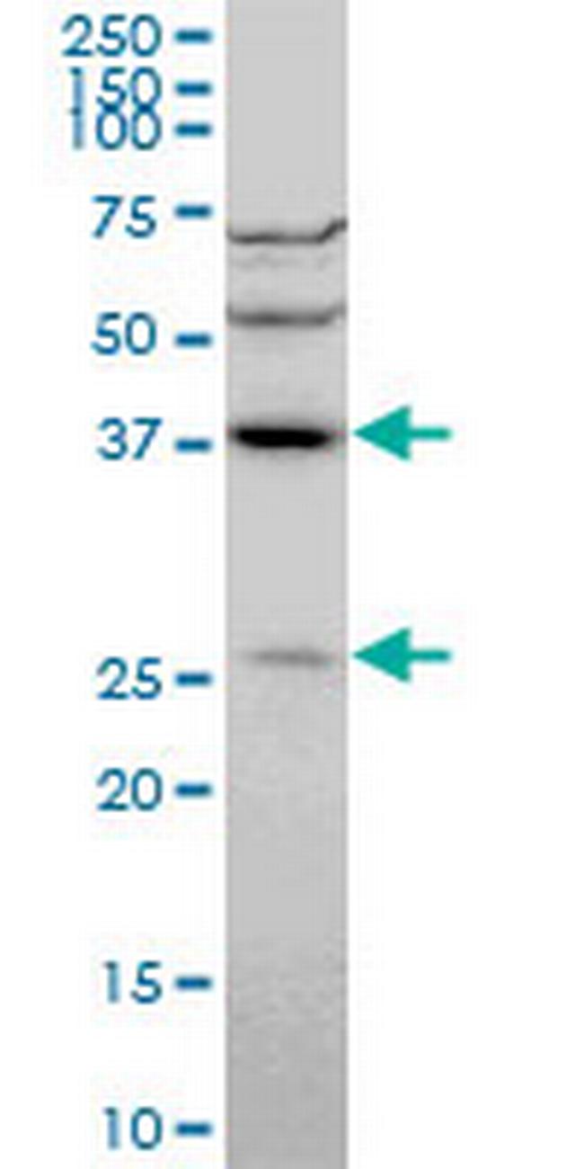 DNAJB6 Antibody in Western Blot (WB)