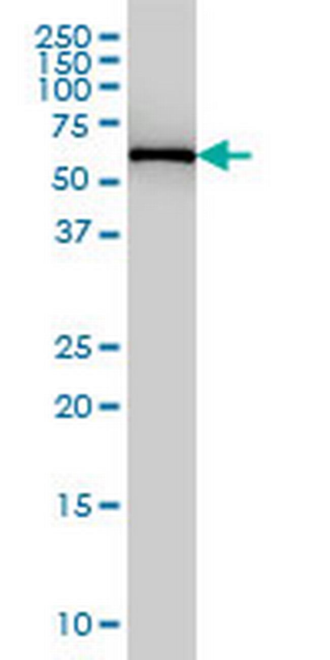 FARSLB Antibody in Western Blot (WB)