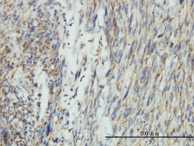 DNM1L Antibody in Immunohistochemistry (Paraffin) (IHC (P))