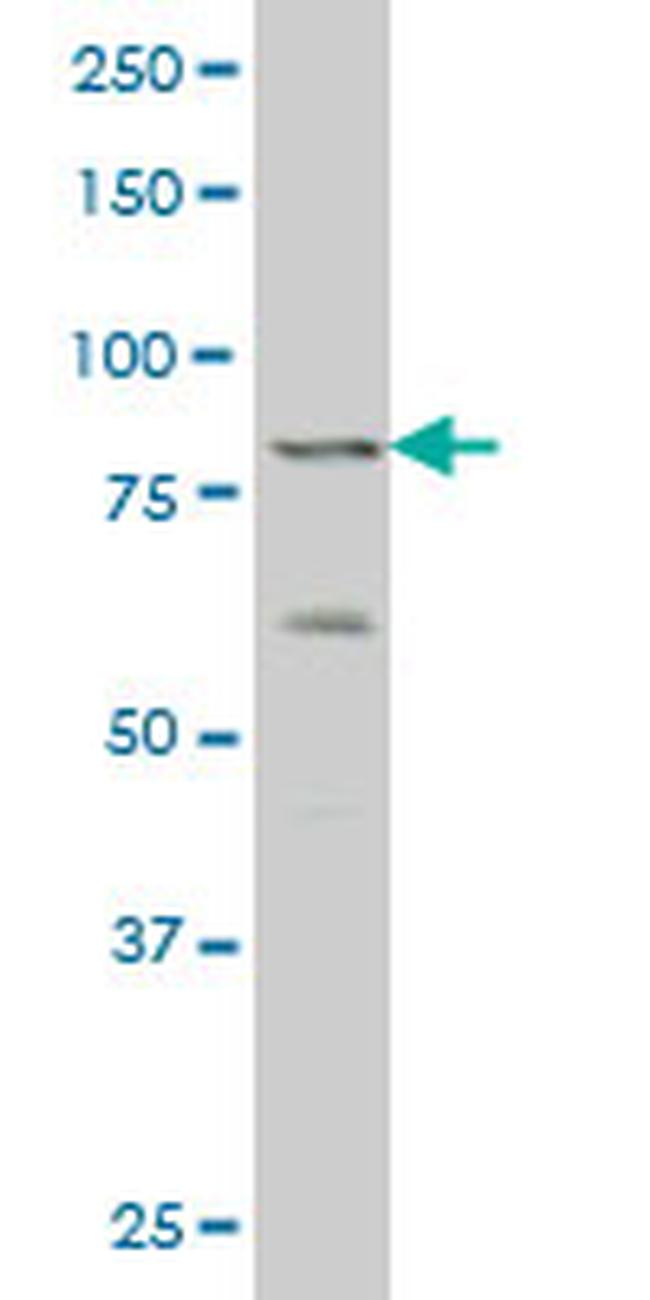 ZNF263 Antibody in Western Blot (WB)