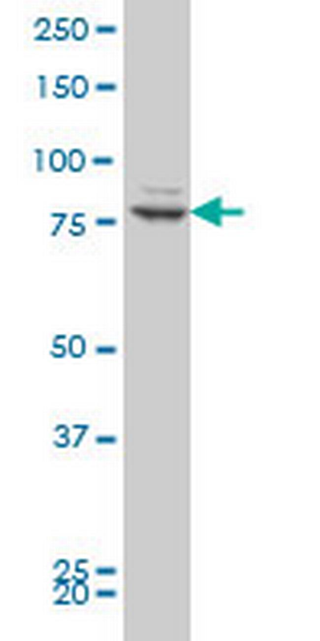 ZNF263 Antibody in Western Blot (WB)