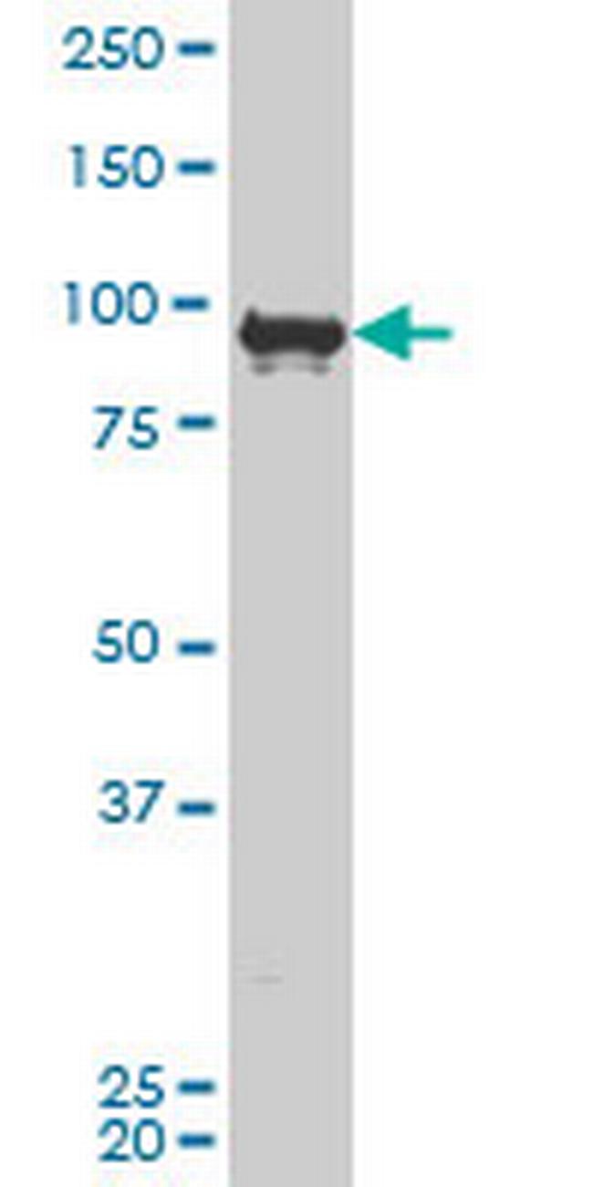 ZNF263 Antibody in Western Blot (WB)