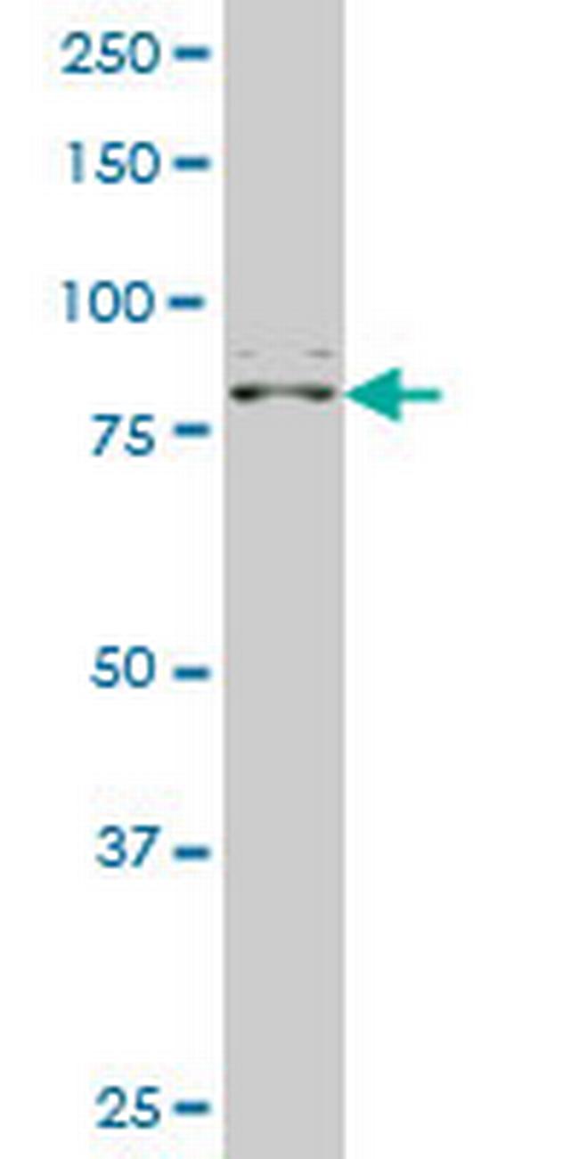 ZNF263 Antibody in Western Blot (WB)