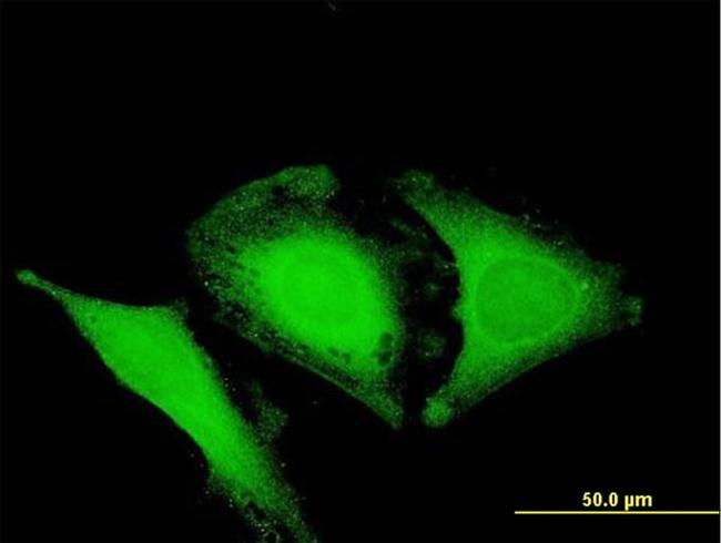 OPTN Antibody in Immunocytochemistry (ICC/IF)