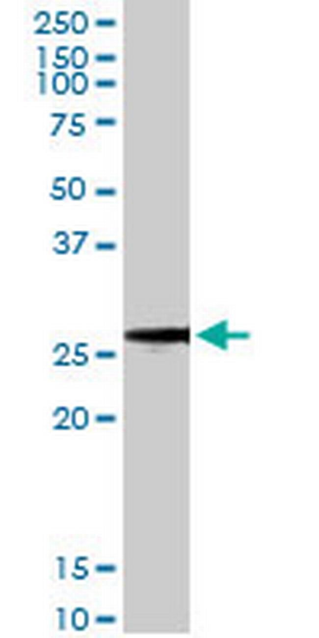 BCAP31 Antibody in Western Blot (WB)