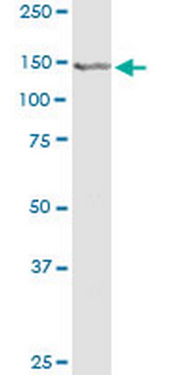 CEBPZ Antibody in Western Blot (WB)