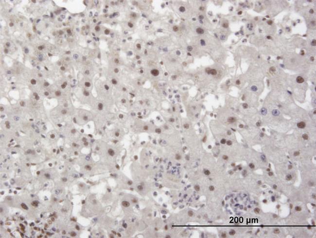 TRIM28 Antibody in Immunohistochemistry (Paraffin) (IHC (P))