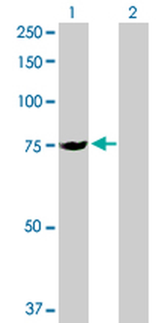 SLC25A13 Antibody in Western Blot (WB)