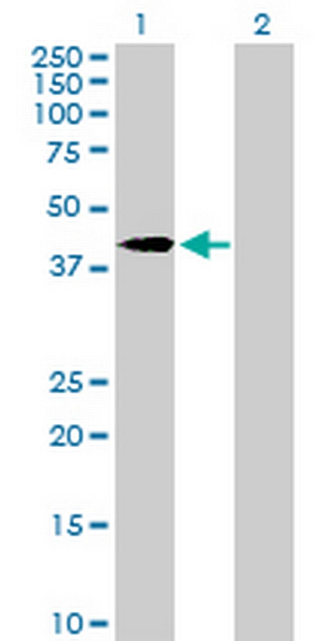 SORBS3 Antibody in Western Blot (WB)