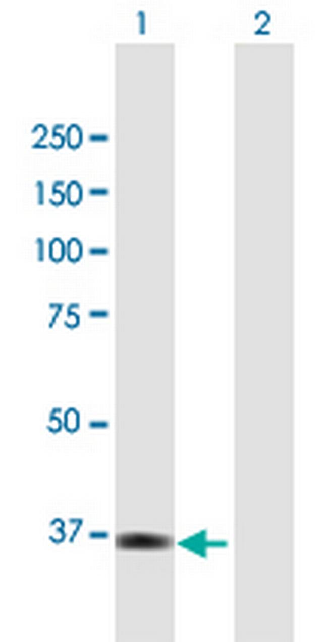 TNK2 Antibody in Western Blot (WB)