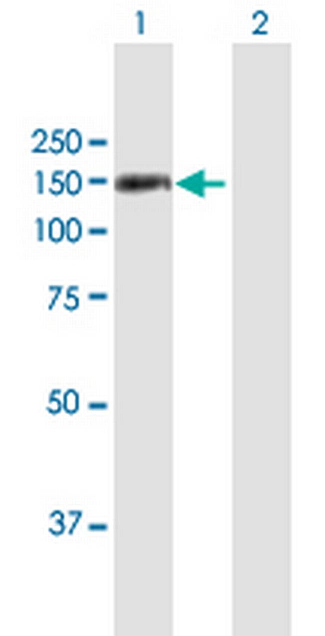 TSHZ1 Antibody in Western Blot (WB)