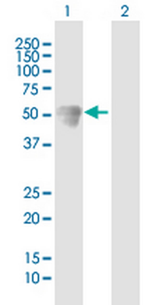 CALCOCO2 Antibody in Western Blot (WB)