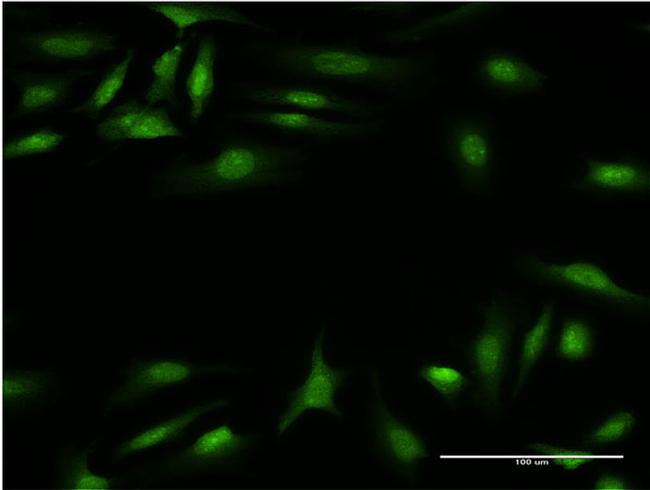 CALCOCO2 Antibody in Immunocytochemistry (ICC/IF)