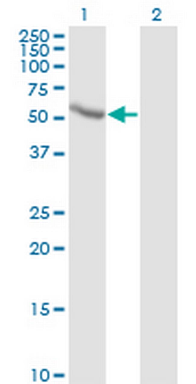 CALCOCO2 Antibody in Western Blot (WB)