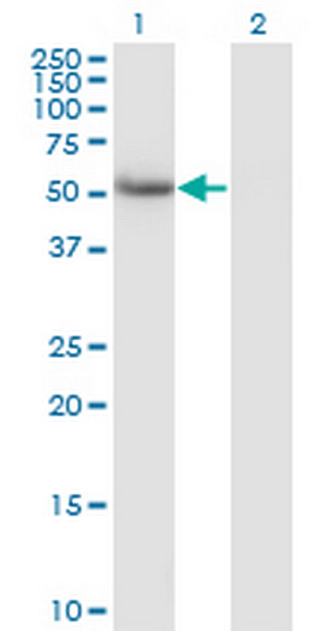 CALCOCO2 Antibody in Western Blot (WB)