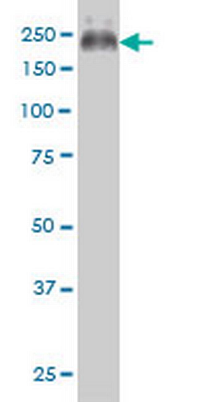 ABCC4 Antibody in Western Blot (WB)