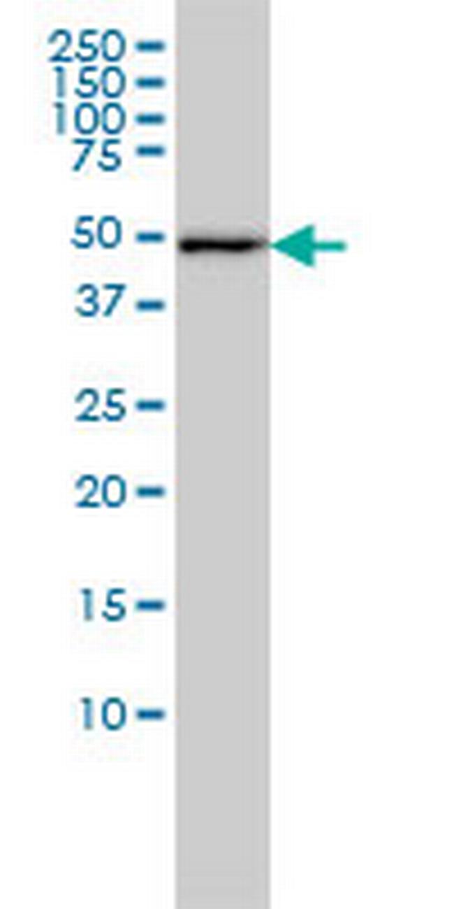 DNAJA2 Antibody in Western Blot (WB)