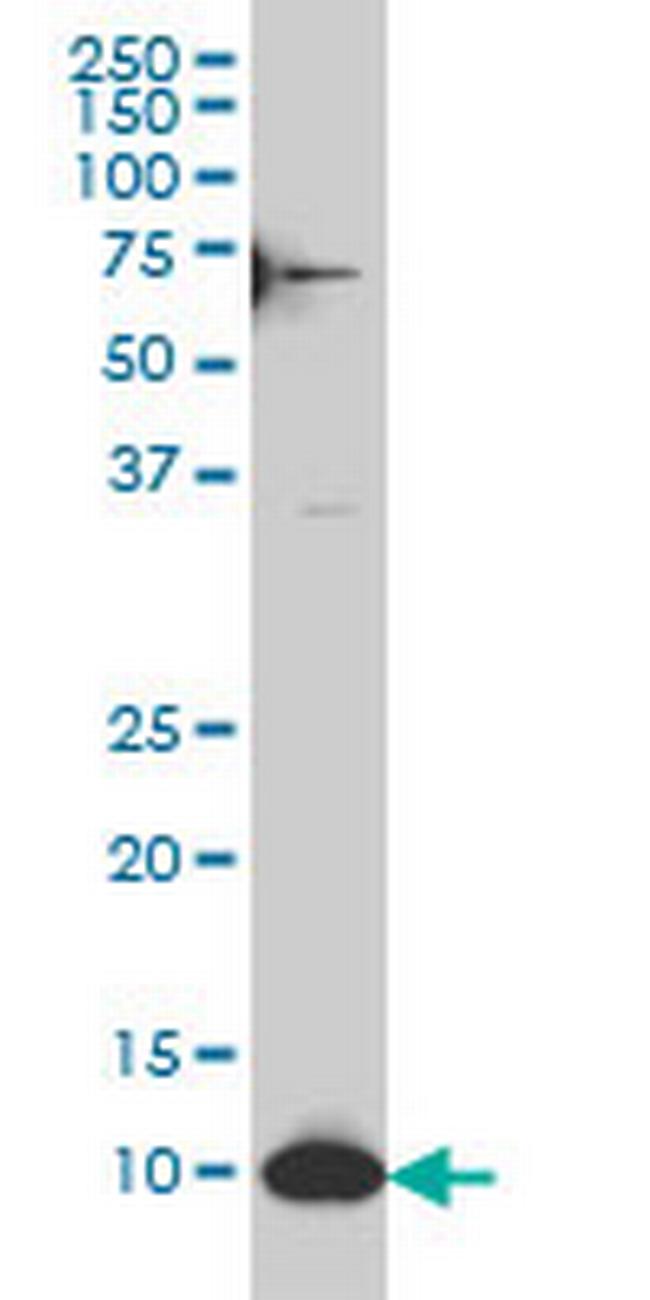 SNAPC5 Antibody in Western Blot (WB)