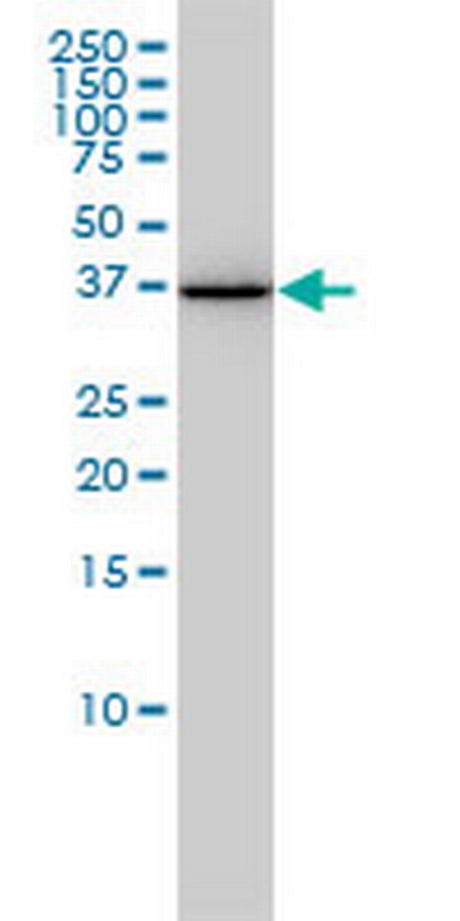 AKR1A1 Antibody in Western Blot (WB)