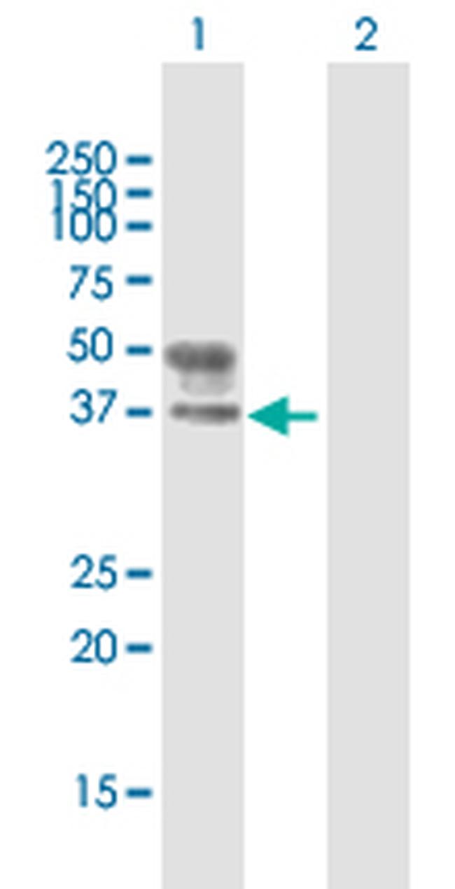 B3GNT3 Antibody in Western Blot (WB)