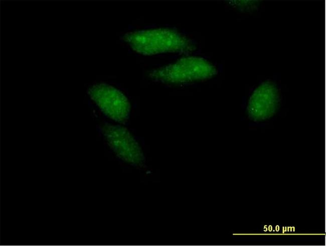 PCGF3 Antibody in Immunocytochemistry (ICC/IF)