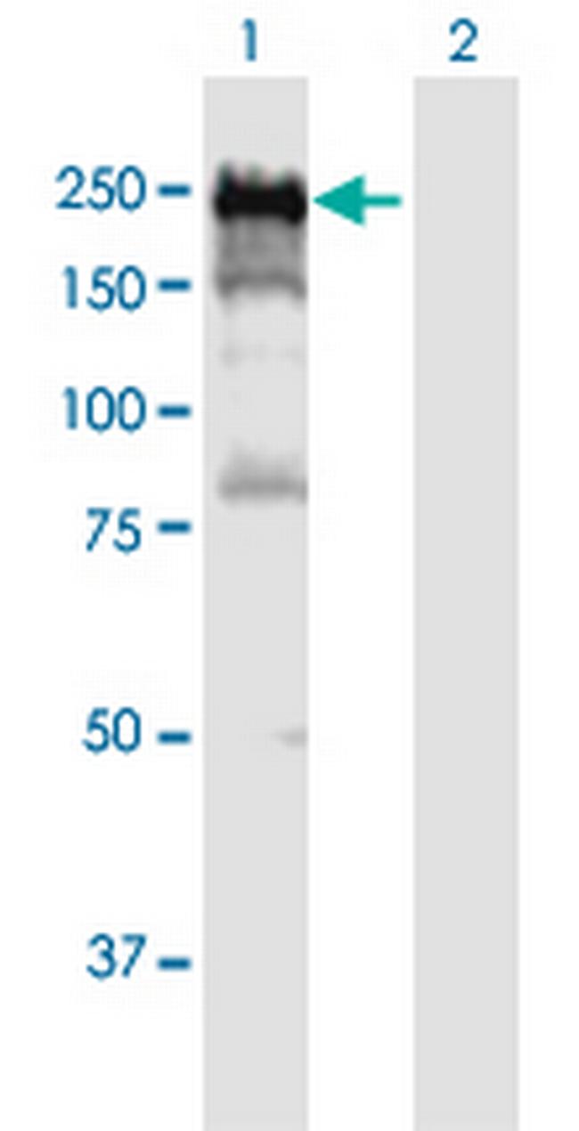 DLC1 Antibody in Western Blot (WB)