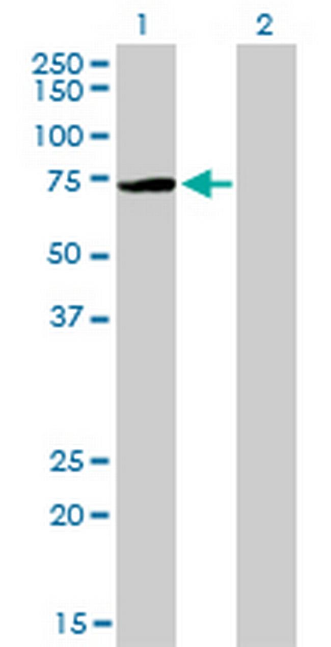 PIAS3 Antibody in Western Blot (WB)