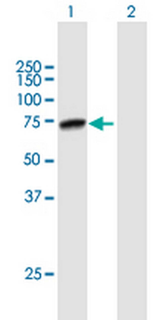 PRMT5 Antibody in Western Blot (WB)