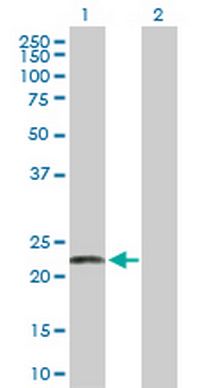 LYPLA1 Antibody in Western Blot (WB)