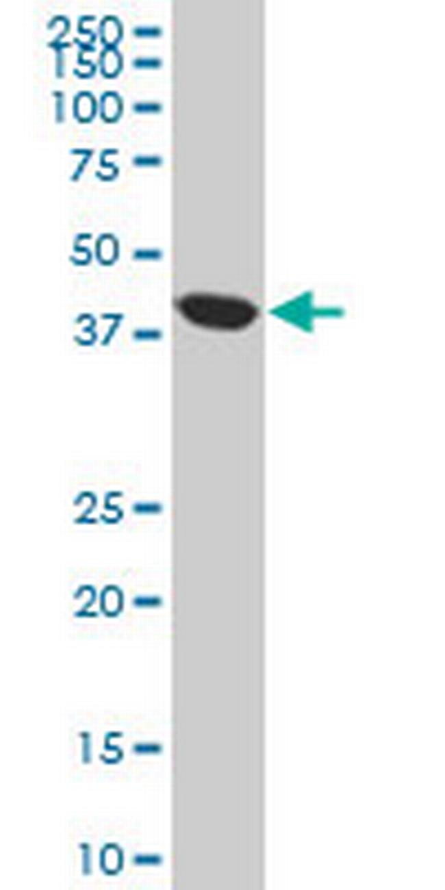 ACAA2 Antibody in Western Blot (WB)