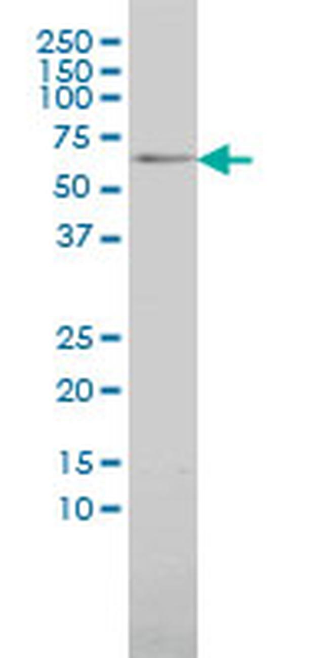 MAP3K7IP1 Antibody in Western Blot (WB)