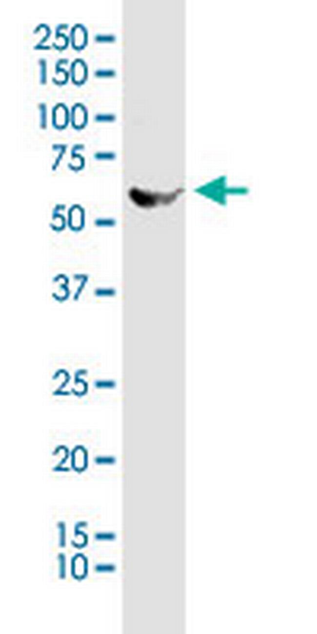 STK25 Antibody in Western Blot (WB)