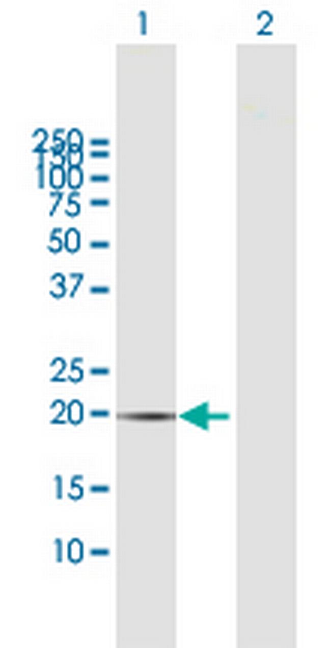 CIB1 Antibody in Western Blot (WB)