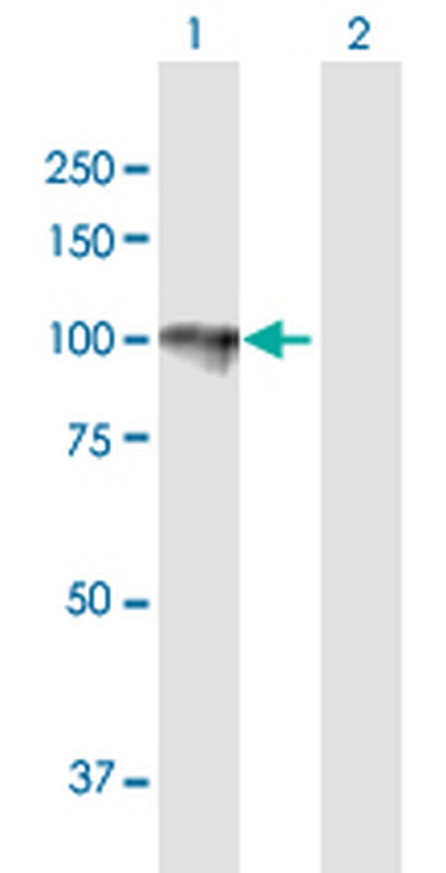 HYOU1 Antibody in Western Blot (WB)