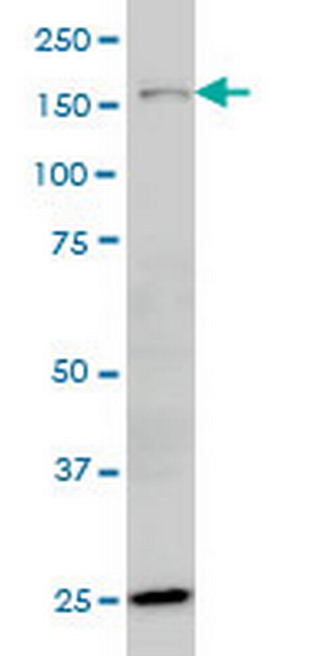 HYOU1 Antibody in Western Blot (WB)