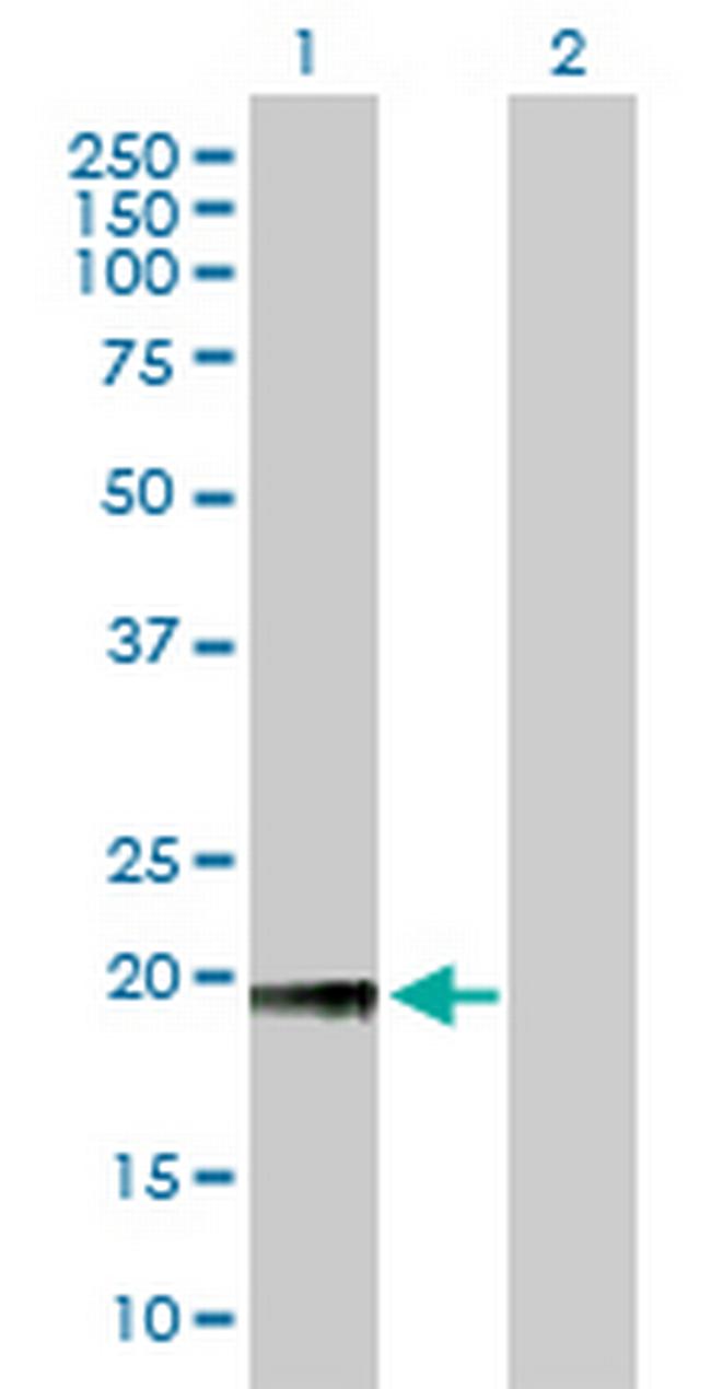 NOL5A Antibody in Western Blot (WB)