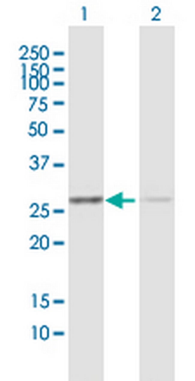 ANP32B Antibody in Western Blot (WB)