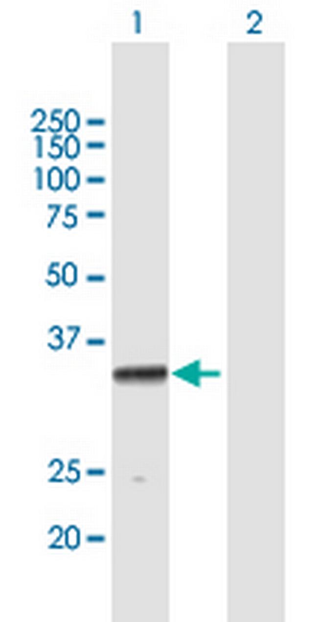 PROCR Antibody in Western Blot (WB)