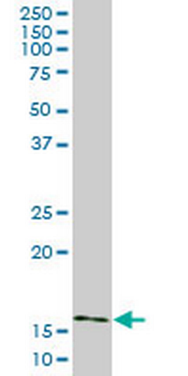 AGR2 Antibody in Western Blot (WB)