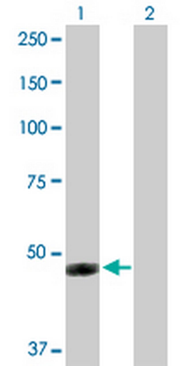 IFI44 Antibody in Western Blot (WB)