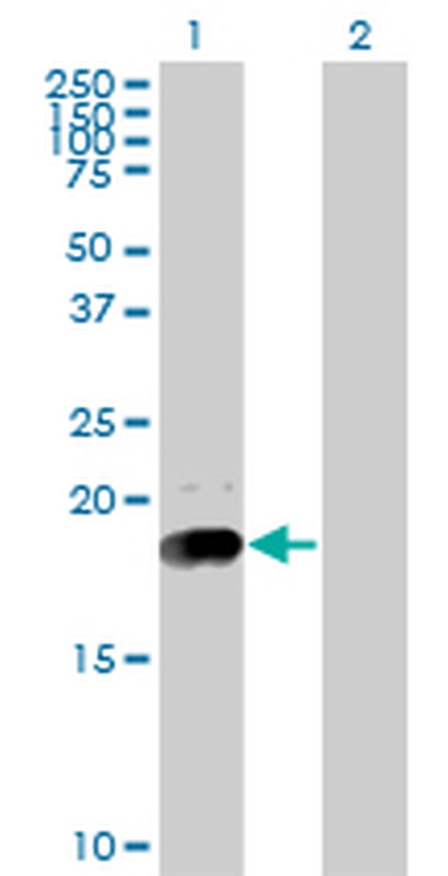 NPC2 Antibody in Western Blot (WB)