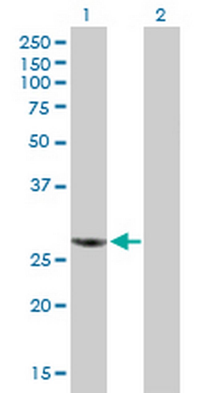 RBCK1 Antibody in Western Blot (WB)