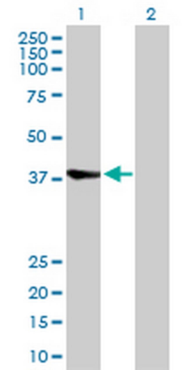 RBCK1 Antibody in Western Blot (WB)