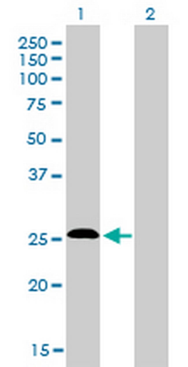 C20orf18 Antibody in Western Blot (WB)