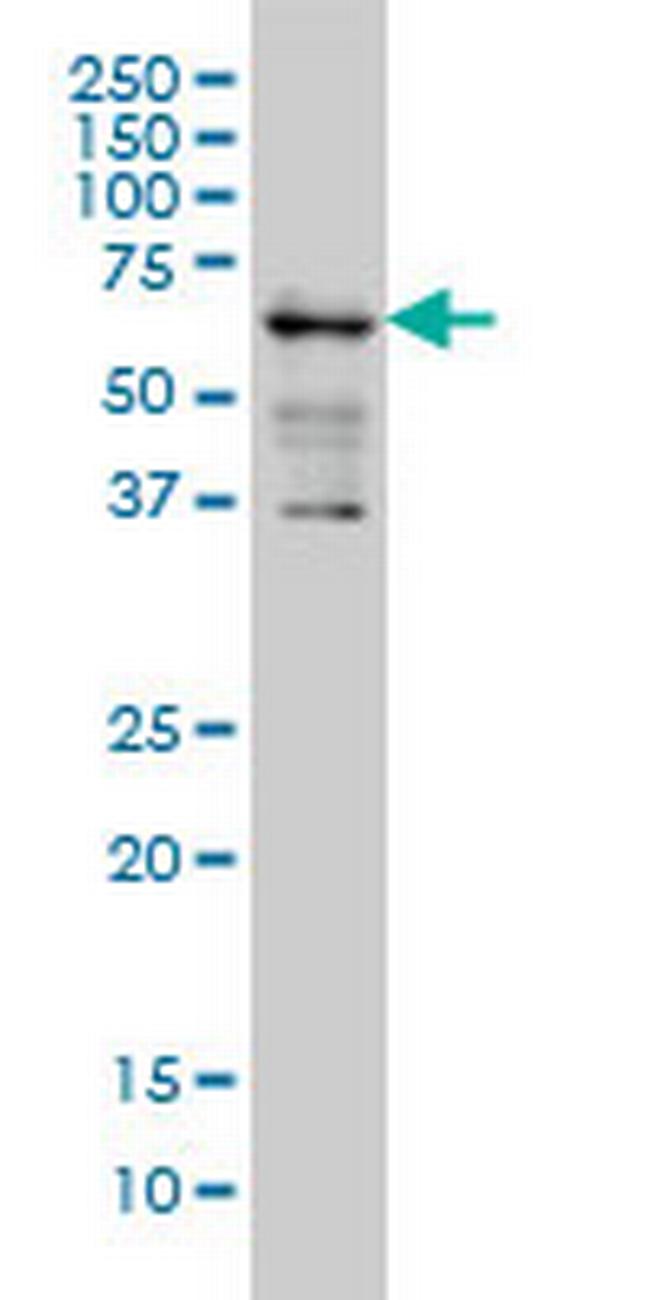 IGF2BP3 Antibody in Western Blot (WB)