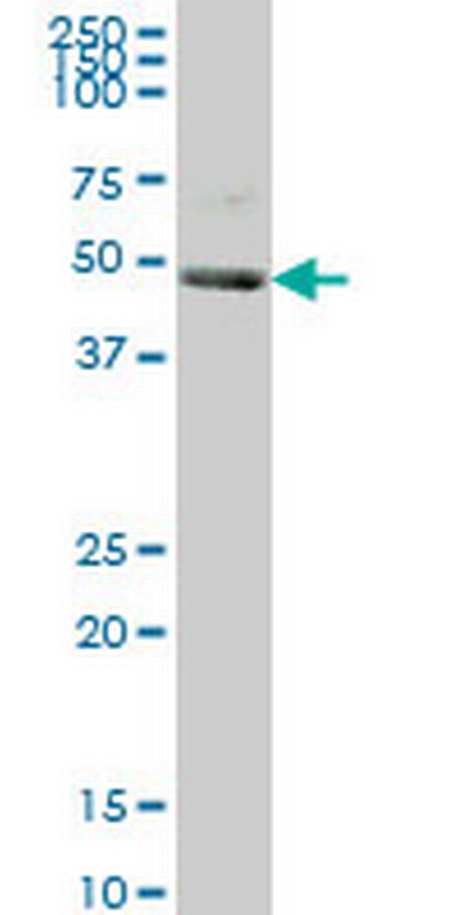 KHDRBS1 Antibody in Western Blot (WB)