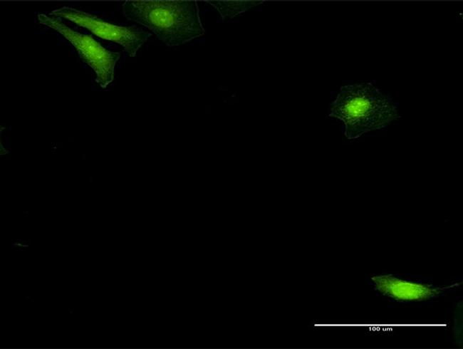 NUDC Antibody in Immunocytochemistry (ICC/IF)