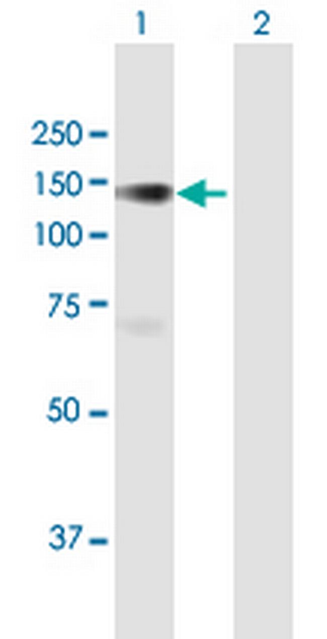 PLK4 Antibody in Western Blot (WB)