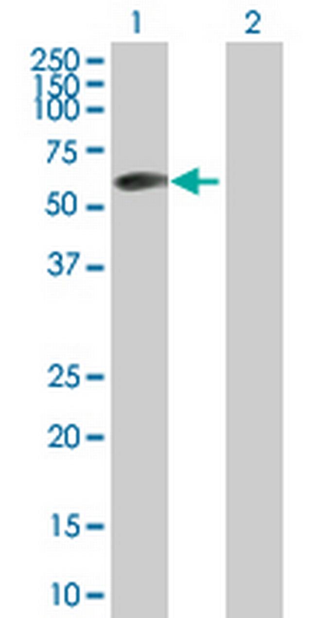 ZBTB6 Antibody in Western Blot (WB)