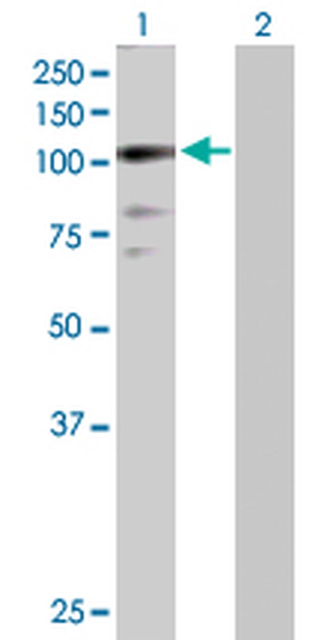 ZNF274 Antibody in Western Blot (WB)